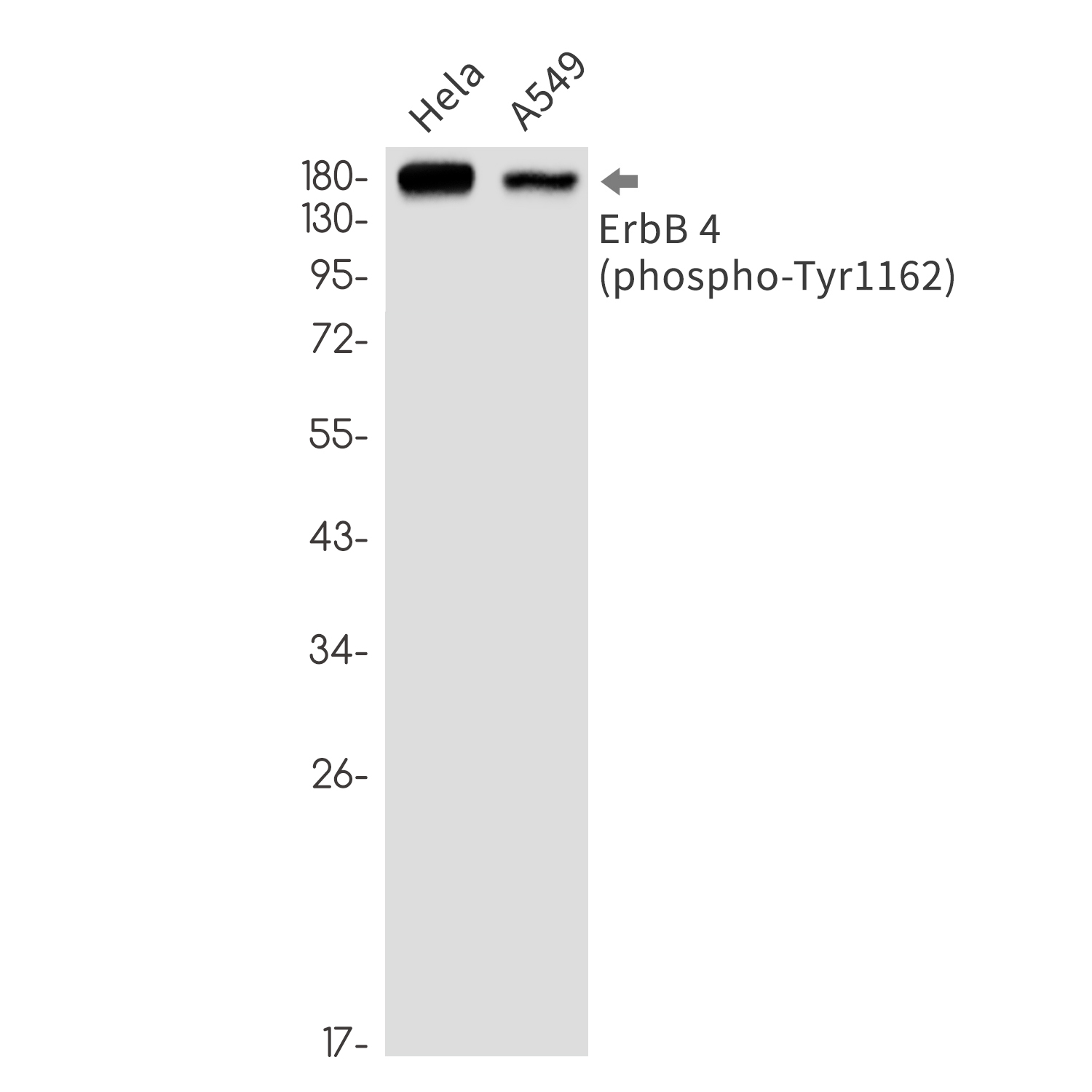Phospho-ErbB 4 (Tyr1162) Rabbit mAb ABZ4362