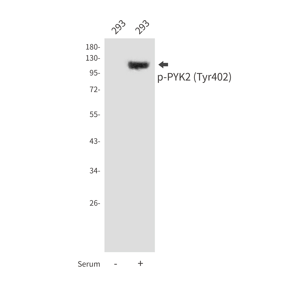 Phospho-PTK2B (Tyr402) Rabbit pAb ABZ4364