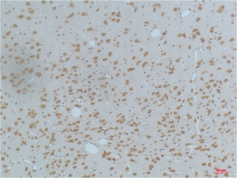 Phospho-CaMKII (Thr287) (3G9) Mouse mAb ABZ4365