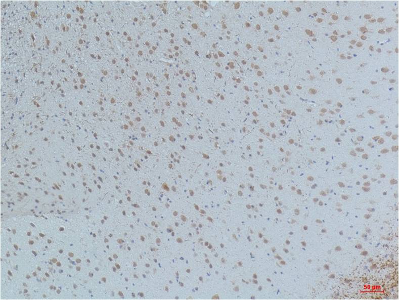 Phospho-CaMKII (Thr287) (3G9) Mouse mAb ABZ4365