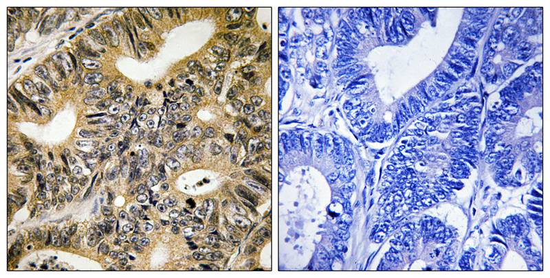 Phospho-4E BP1 (Thr70) Rabbit pAb ABZ4366