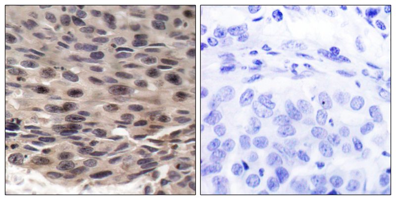 Phospho-4E BP1 (Thr37) Rabbit pAb ABZ4367
