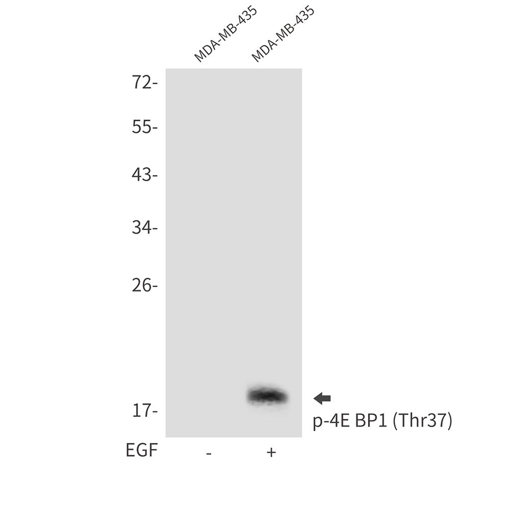 Phospho-4E BP1 (Thr37) Rabbit pAb ABZ4367