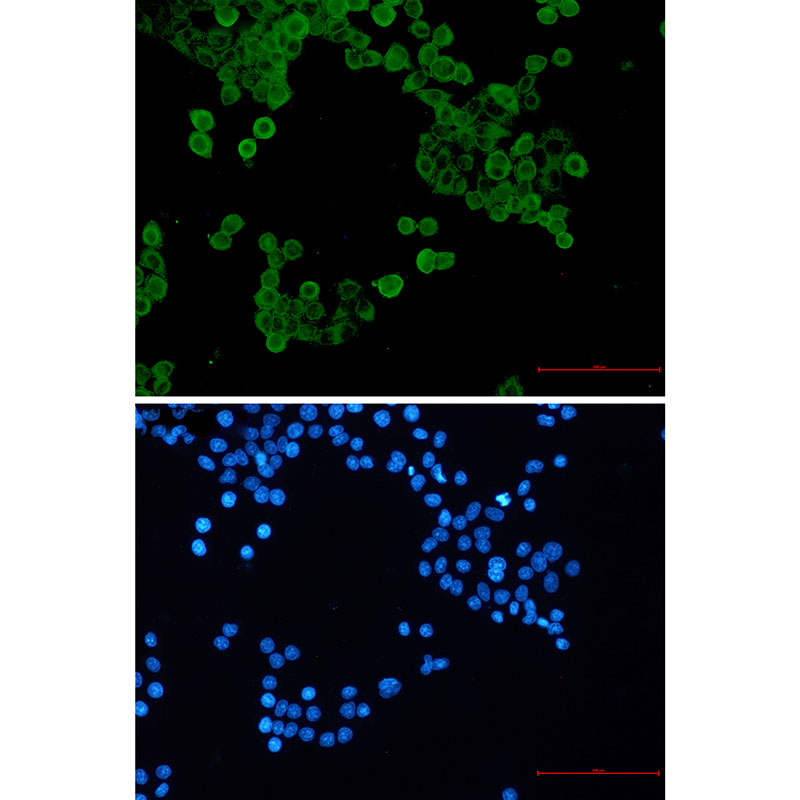Phospho-AMPK alpha 1 (Ser496) Rabbit mAb ABZ4368