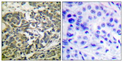 Phospho-AMPK alpha 1/2 (Thr183/Thr172) Rabbit pAb ABZ4369
