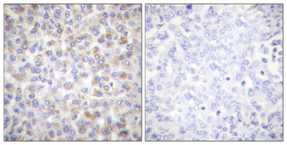 Phospho-AMPK alpha 1/2 (Thr183/Thr172) Rabbit pAb ABZ4369