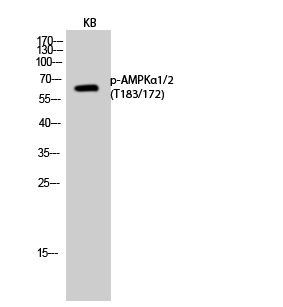 Phospho-AMPK alpha 1/2 (Thr183/Thr172) Rabbit pAb ABZ4369
