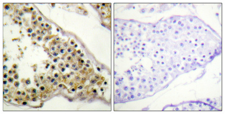 Phospho-ITK (Tyr512) Rabbit pAb ABZ4371