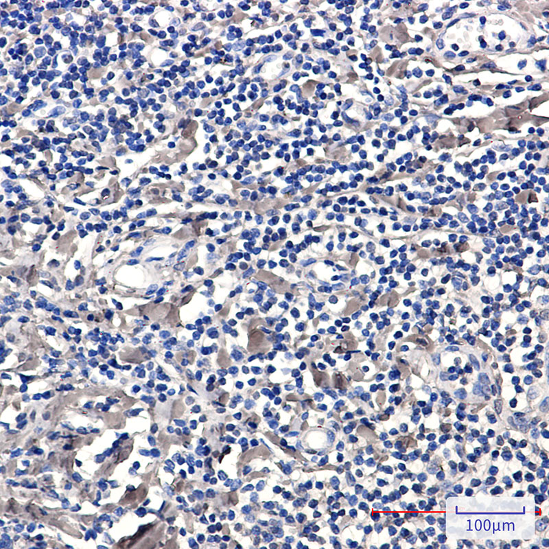 Phospho-PKC delta (Ser299) Rabbit mAb ABZ4372