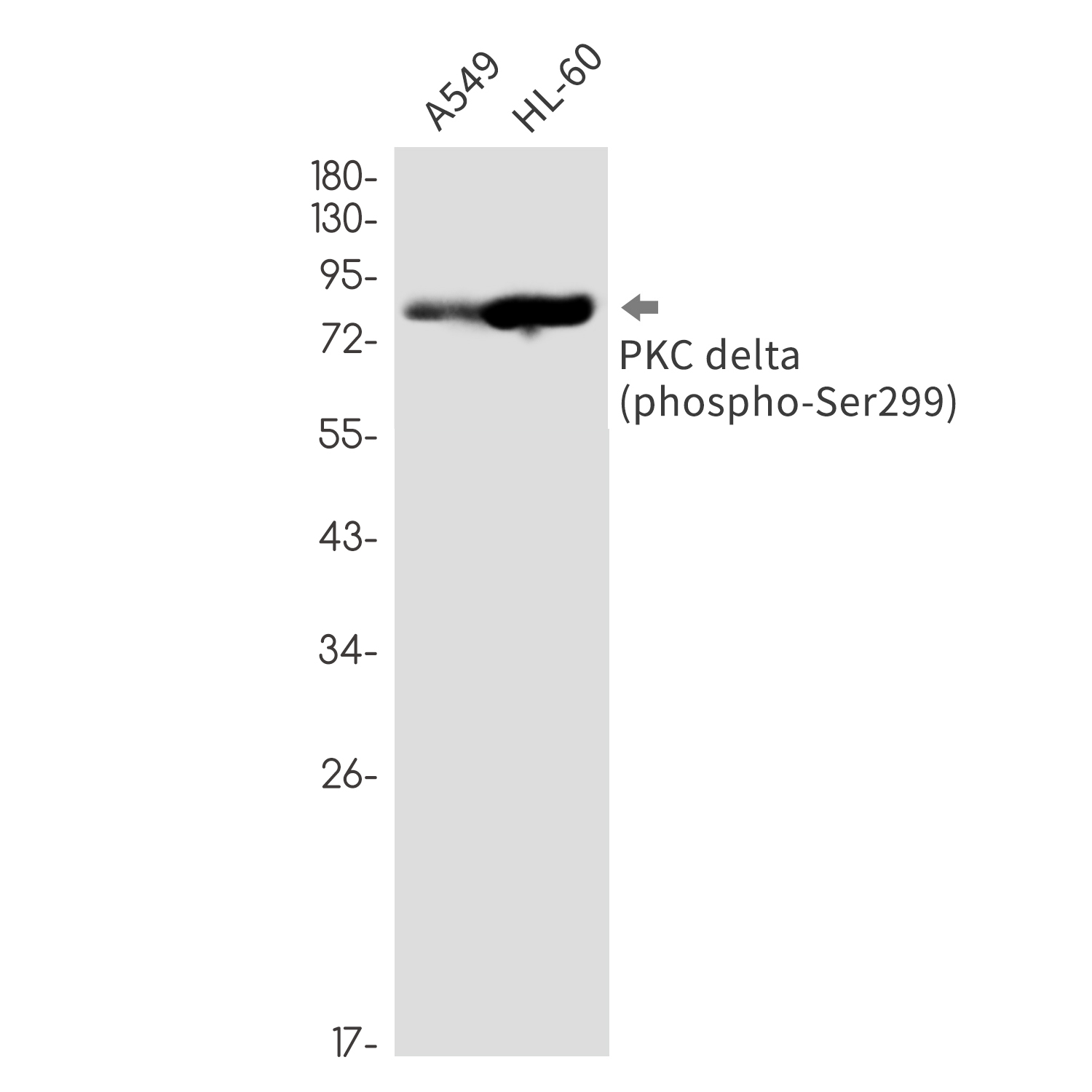 Phospho-PKC delta (Ser299) Rabbit mAb ABZ4372