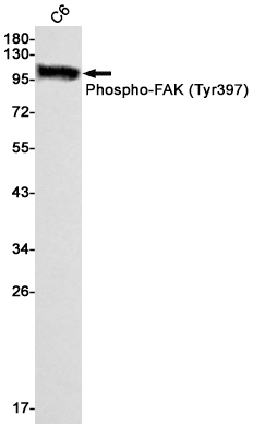 Phospho-FAK (Tyr397) Rabbit mAb ABZ4373