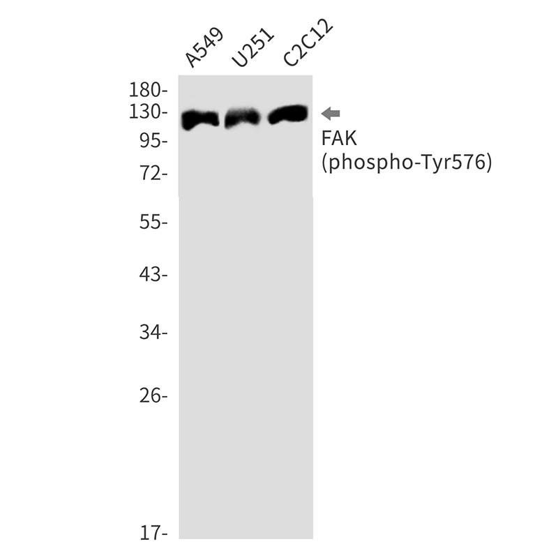 Phospho-FAK (Tyr576) Rabbit mAb ABZ4374