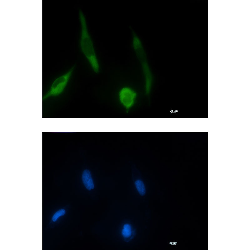 Phospho-MEK1 (Ser298) Rabbit mAb ABZ4376