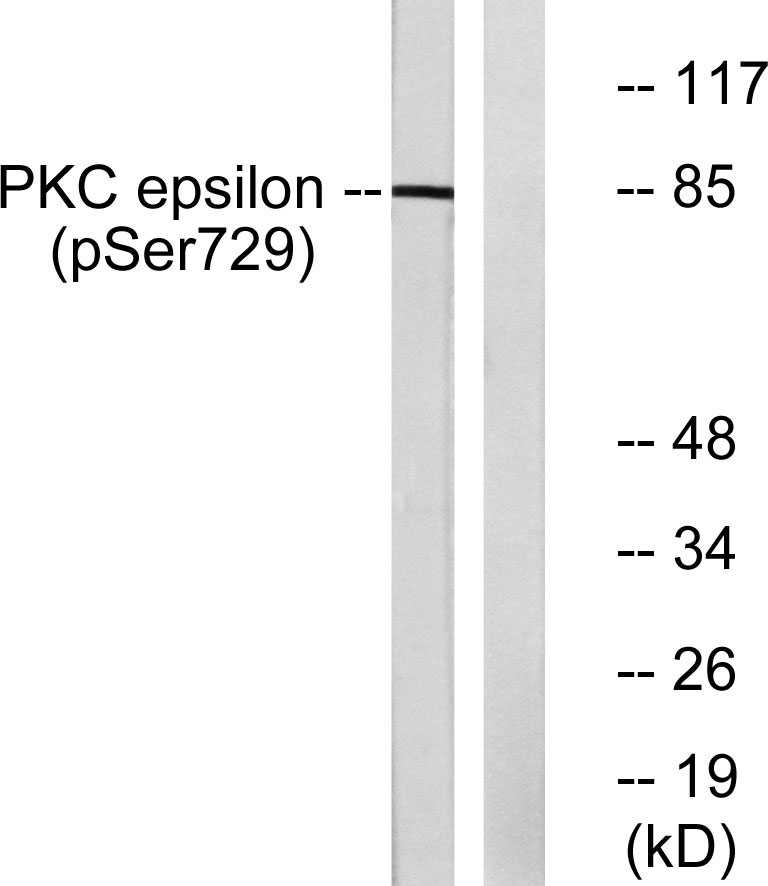 Phospho-PKC epsilon (Ser729) Rabbit pAb ABZ4378