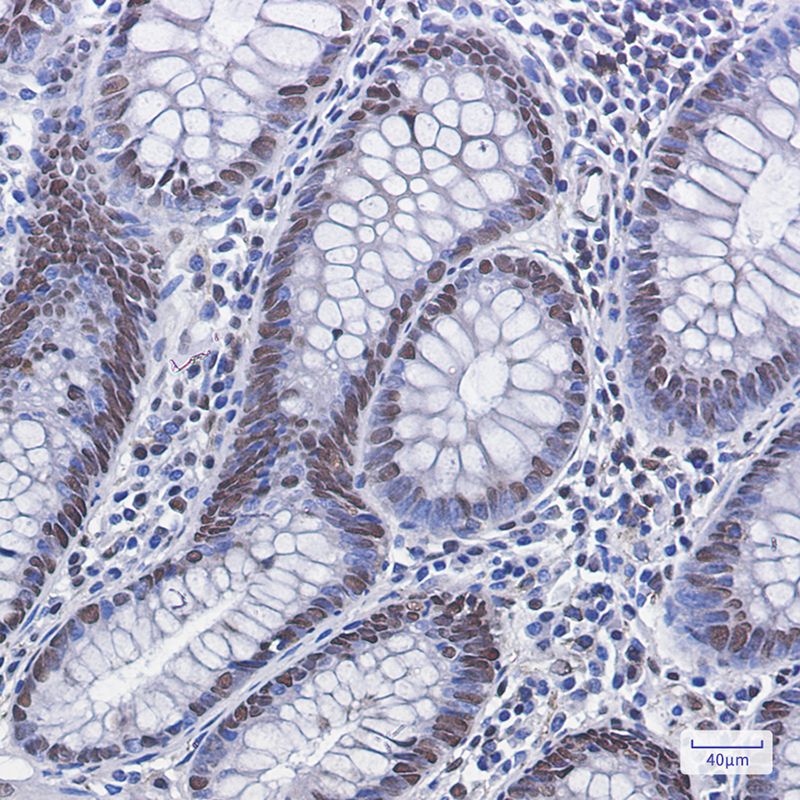 Phospho-MDM2 (Ser166) Rabbit mAb ABZ4379