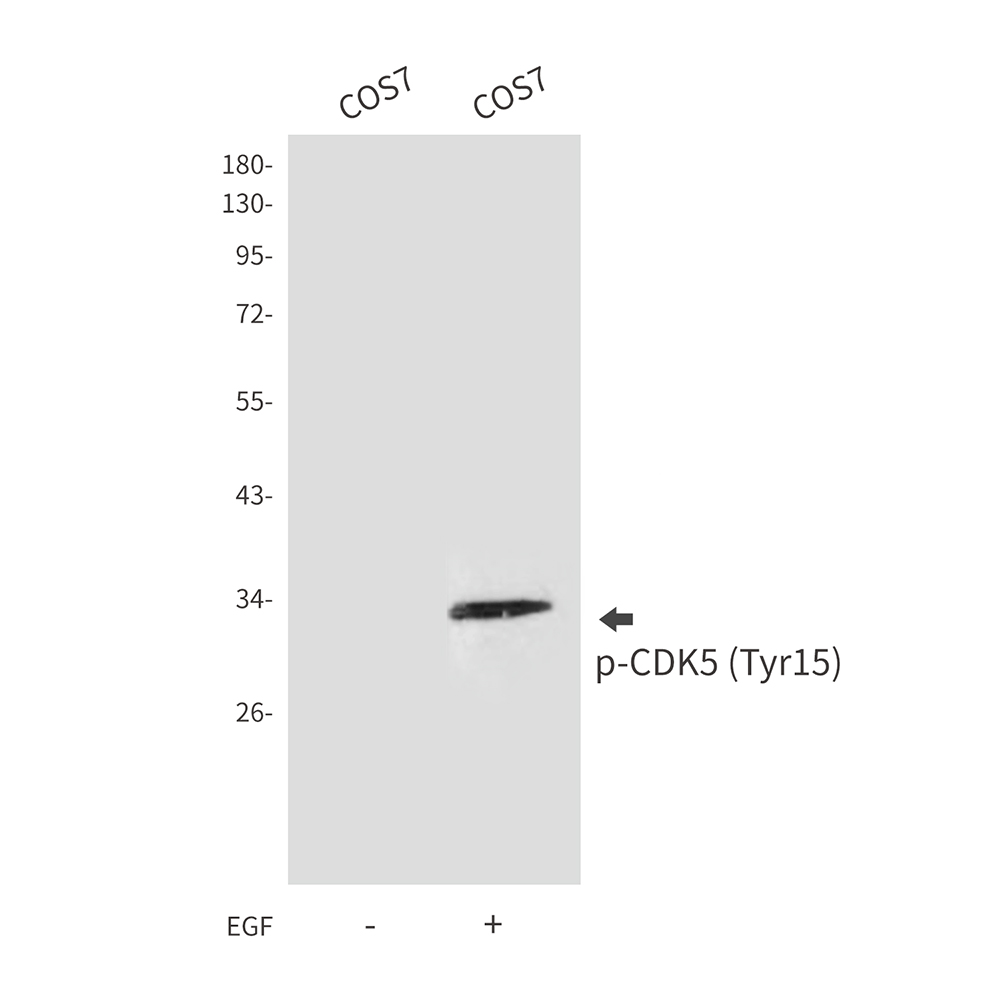 Phospho-CDK5 (Tyr15) Rabbit pAb ABZ4380