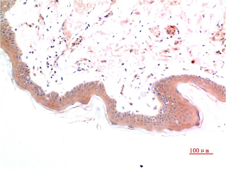 Phospho-Smad3 (Ser425) (7H6) Mouse mAb ABZ4381