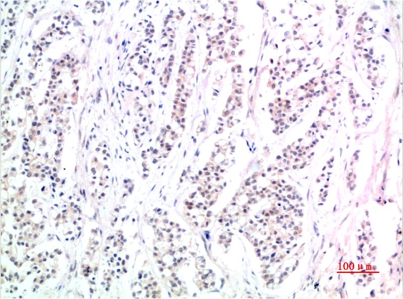 Phospho-Smad3 (Ser425) (7H6) Mouse mAb ABZ4381