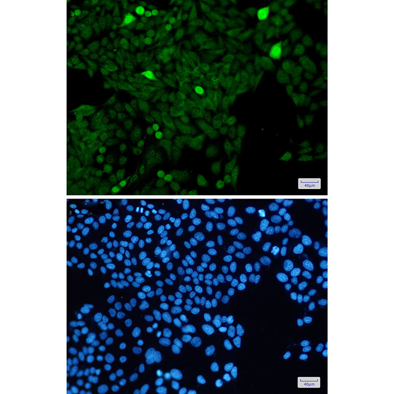 Phospho-Histone H3 (Ser28) Rabbit mAb ABZ4384