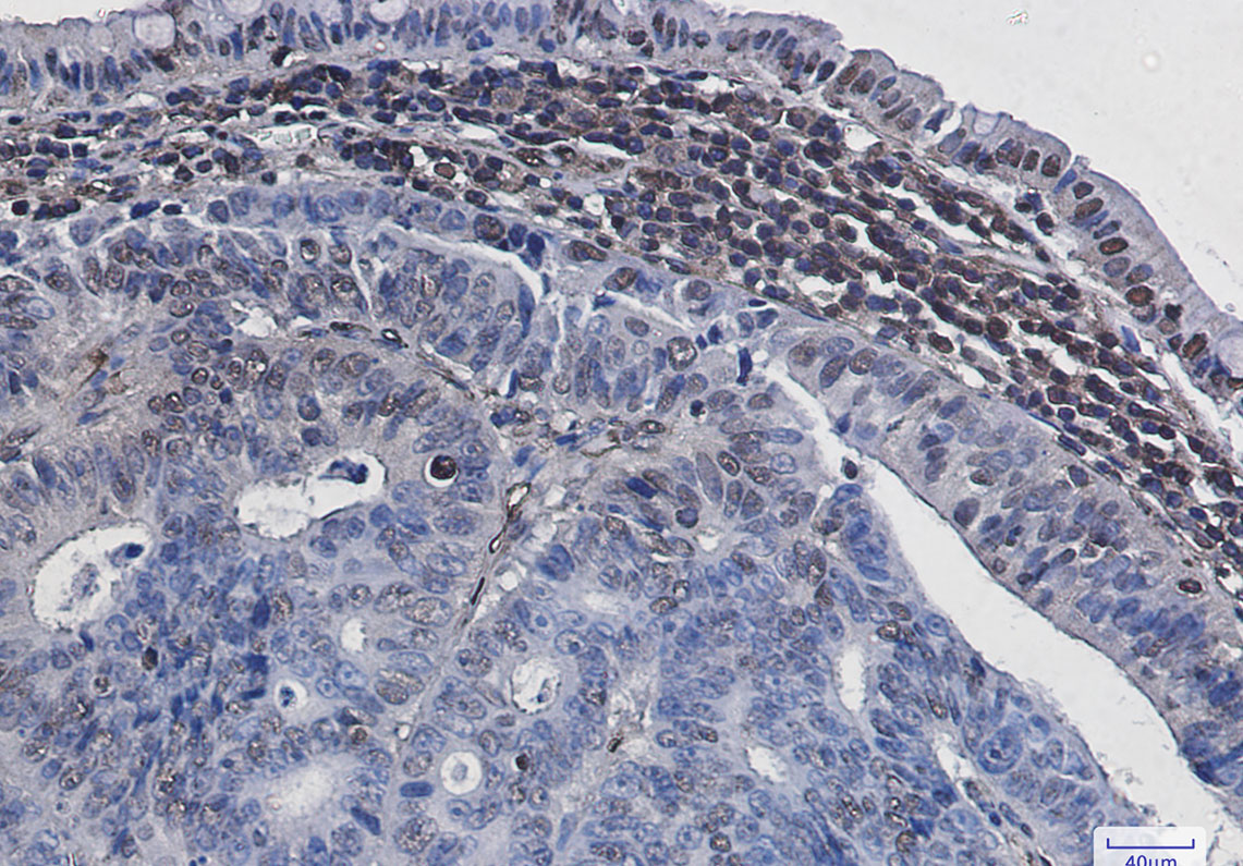 Phospho-Histone H3 (Ser28) Rabbit mAb ABZ4384