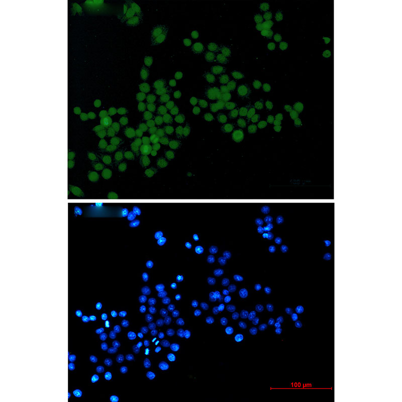 Phospho-Histone H3 (Ser10/Thr11) Rabbit mAb ABZ4386