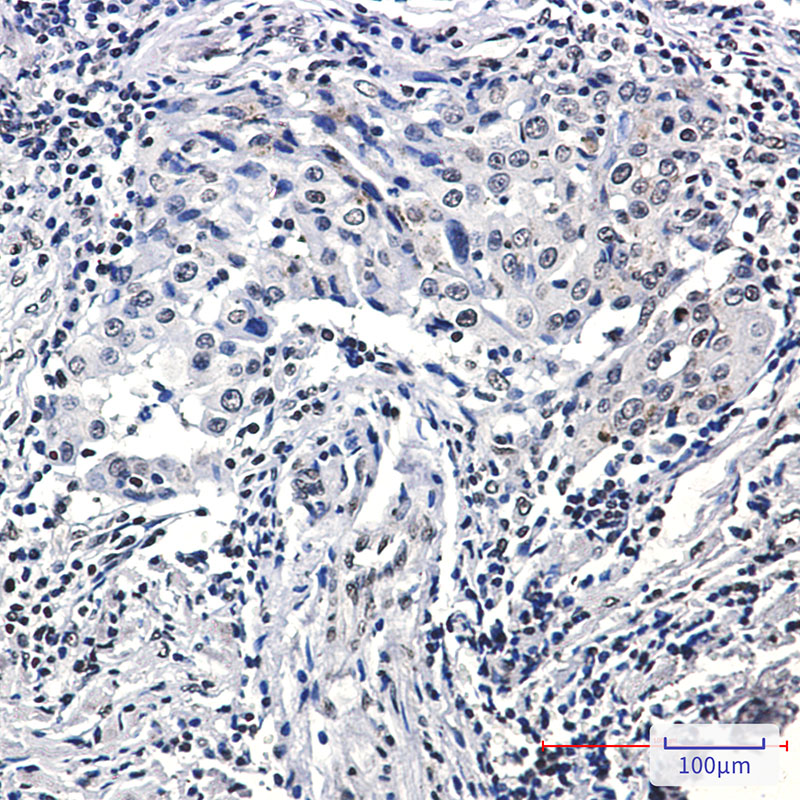 Phospho-Histone H3 (Ser10/Thr11) Rabbit mAb ABZ4386