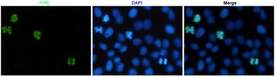 Phospho-Histone H3 (Ser10) Rabbit pAb ABZ4387