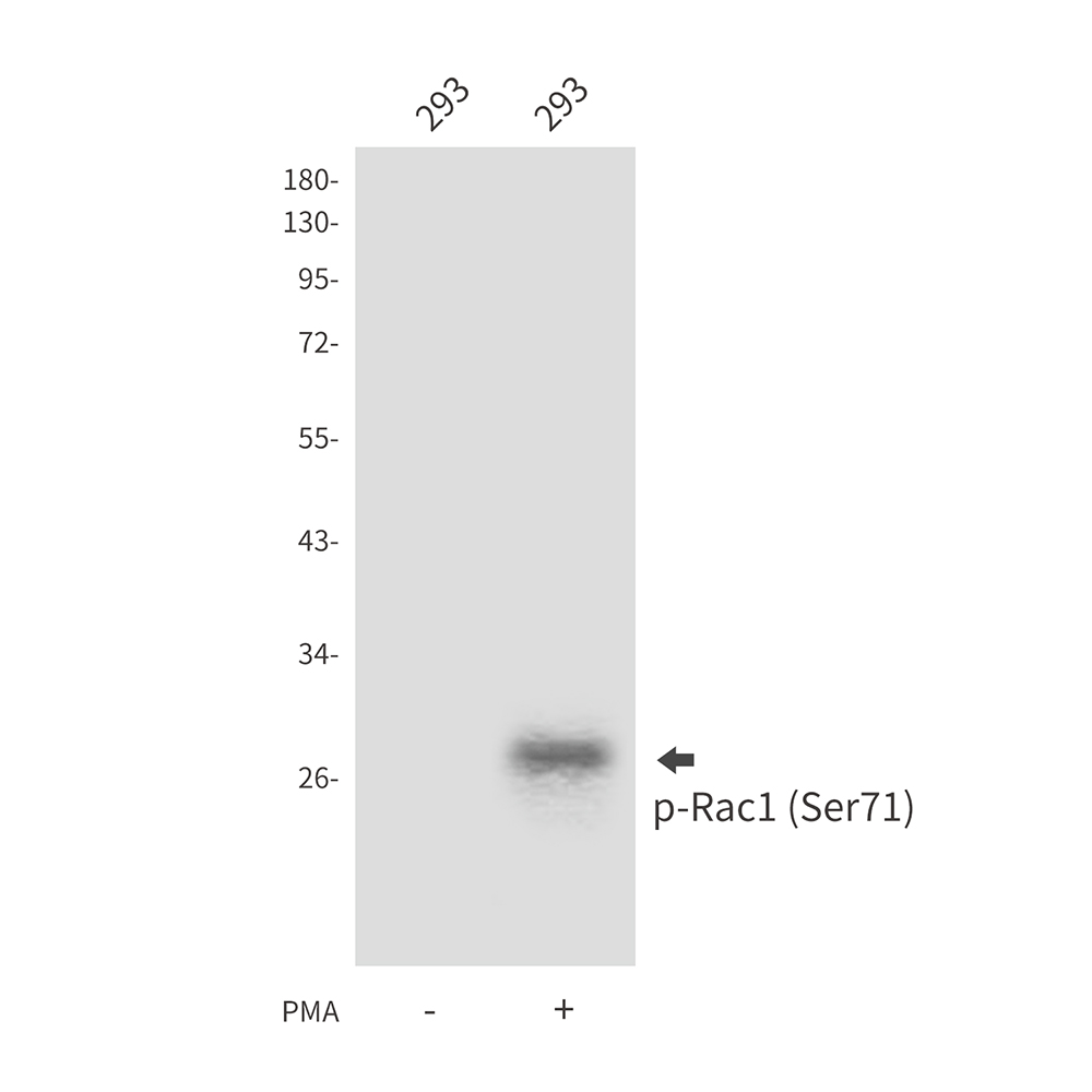 Phospho-Rac1 (Ser71) Rabbit pAb ABZ4388