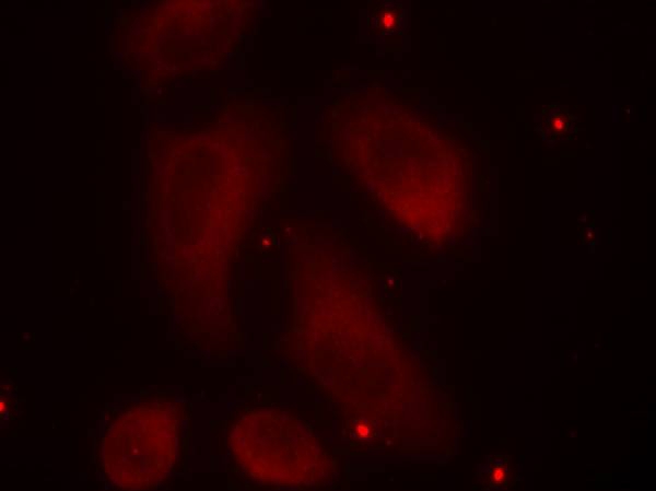 Phospho-LIM Kinase 1 (Thr508) Rabbit pAb ABZ4389