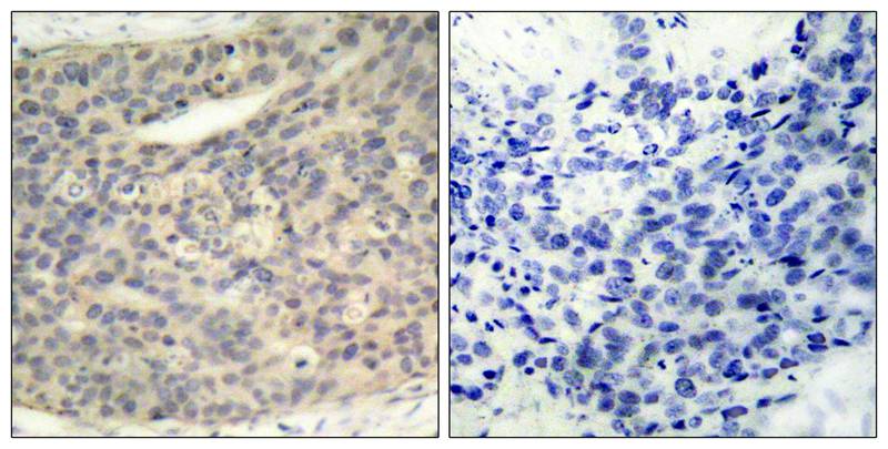 Phospho-LIM Kinase 1 (Thr508) Rabbit pAb ABZ4389