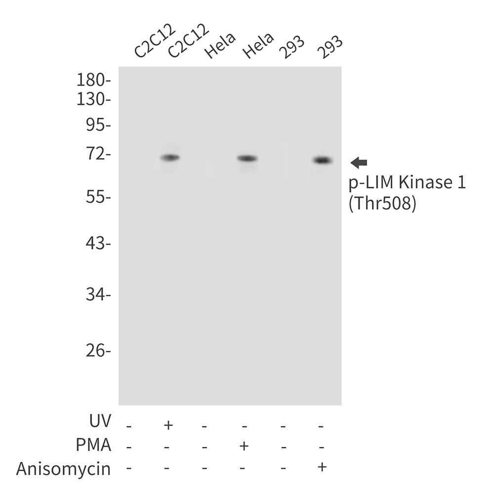 Phospho-LIM Kinase 1 (Thr508) Rabbit pAb ABZ4389