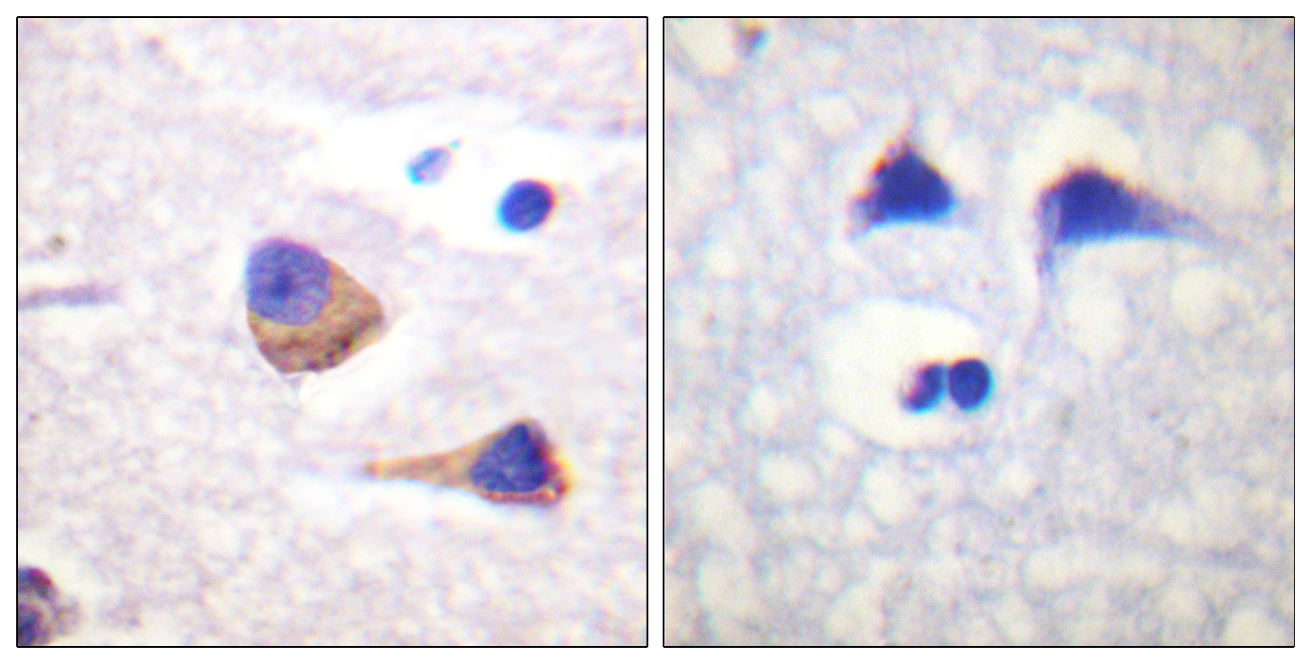 Phospho-JAK3 (Tyr785) Rabbit pAb ABZ4390