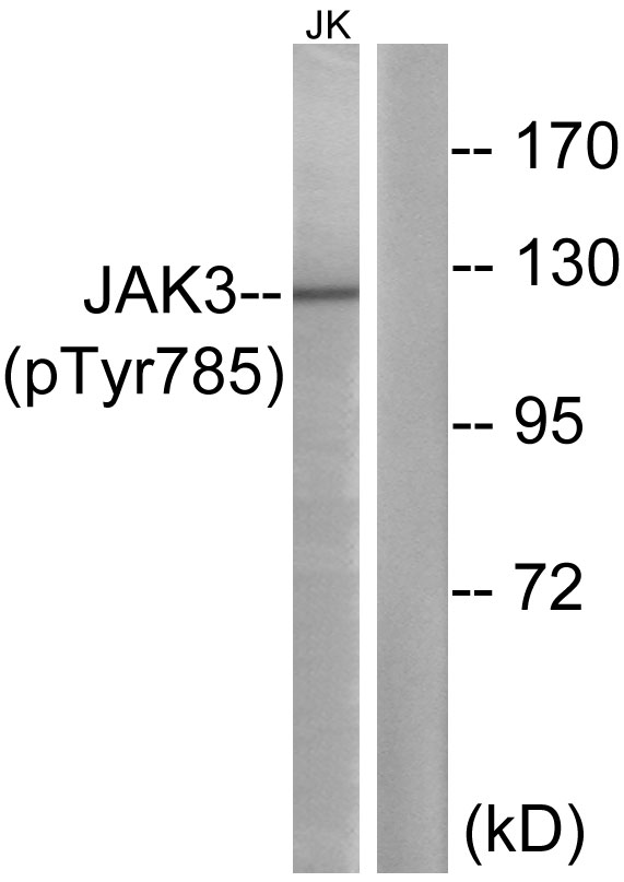 Phospho-JAK3 (Tyr785) Rabbit pAb ABZ4390
