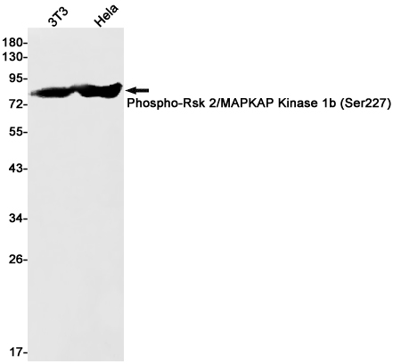Phospho-RSK2 (Ser227) Rabbit mAb ABZ4391