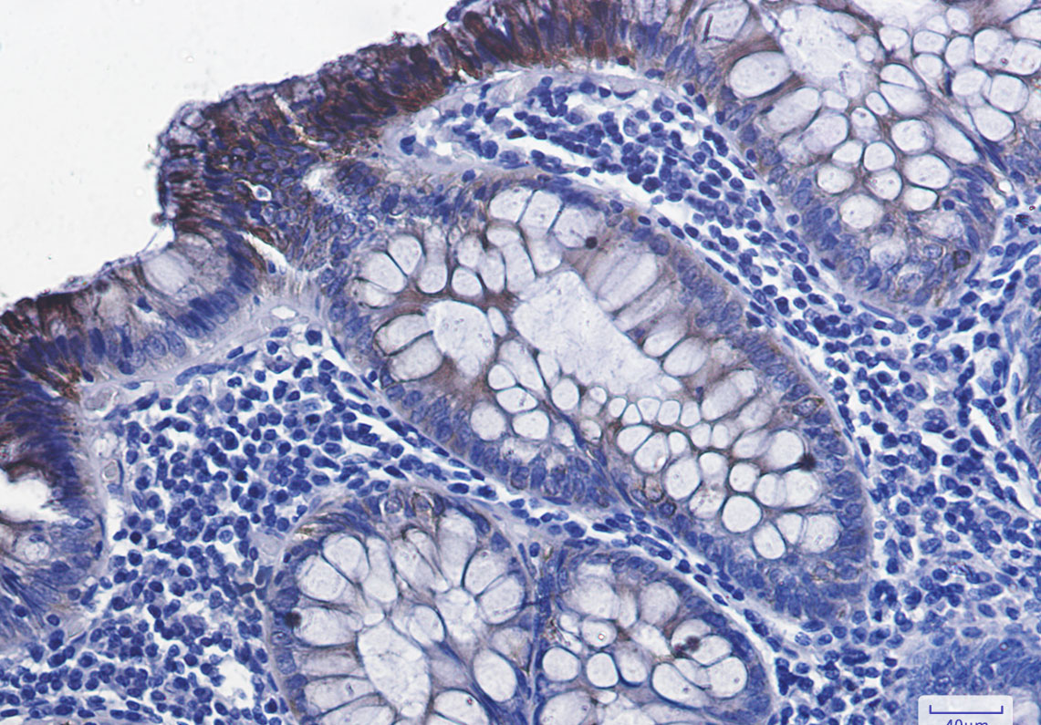 Phospho-GSK3 beta (Ser9) Rabbit mAb ABZ4392