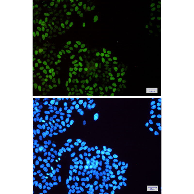 Phospho-MCM2 (Ser108) Rabbit mAb ABZ4395