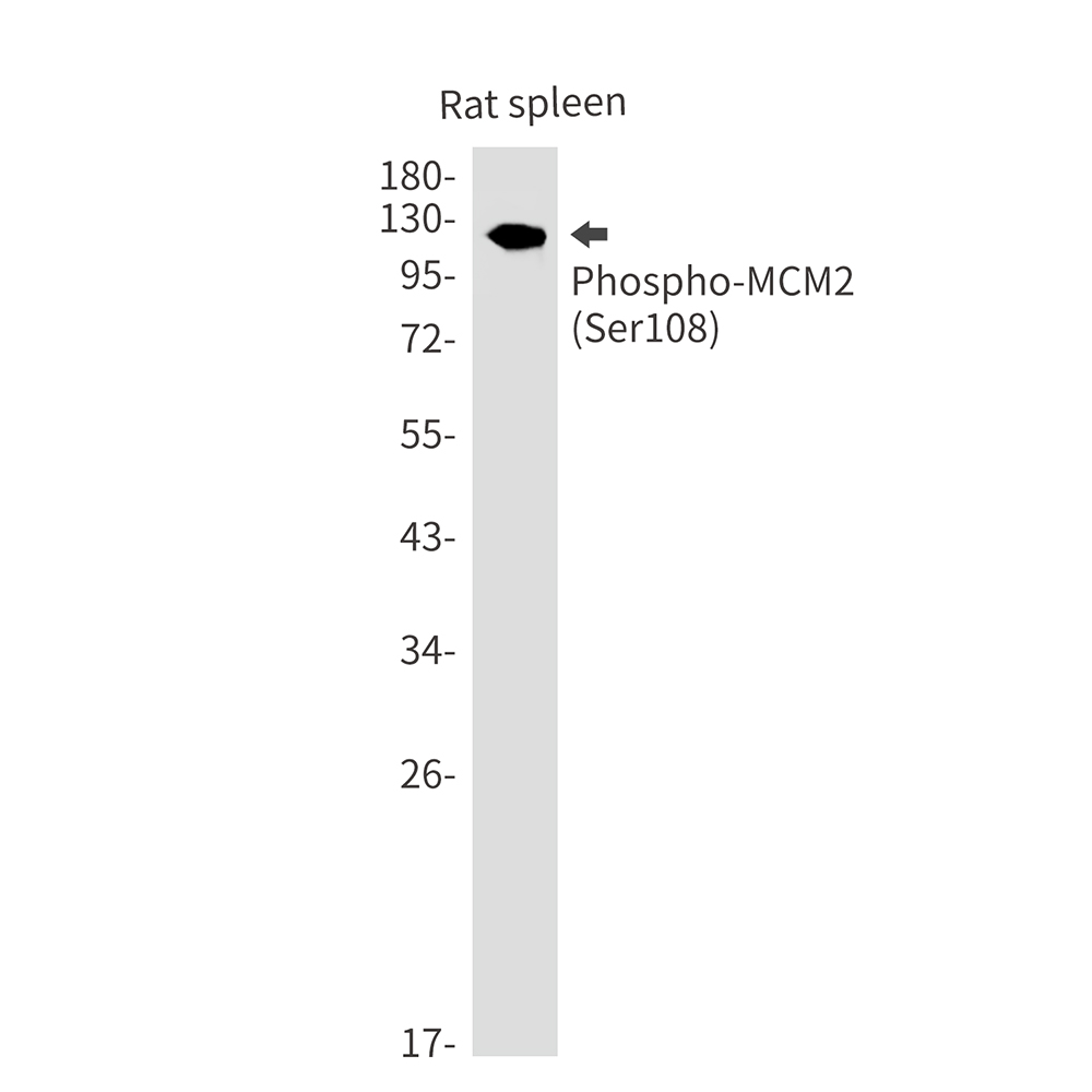 Phospho-MCM2 (Ser108) Rabbit mAb ABZ4395