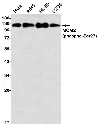 Phospho-MCM2 (Ser27) Rabbit mAb ABZ4396