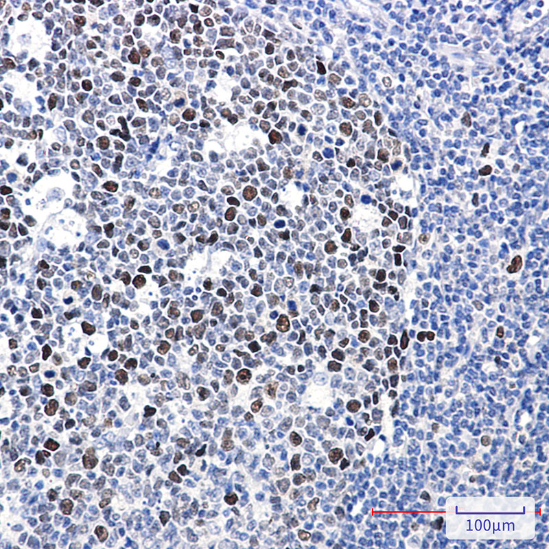 Phospho-MCM2 (Ser40) Rabbit mAb ABZ4397