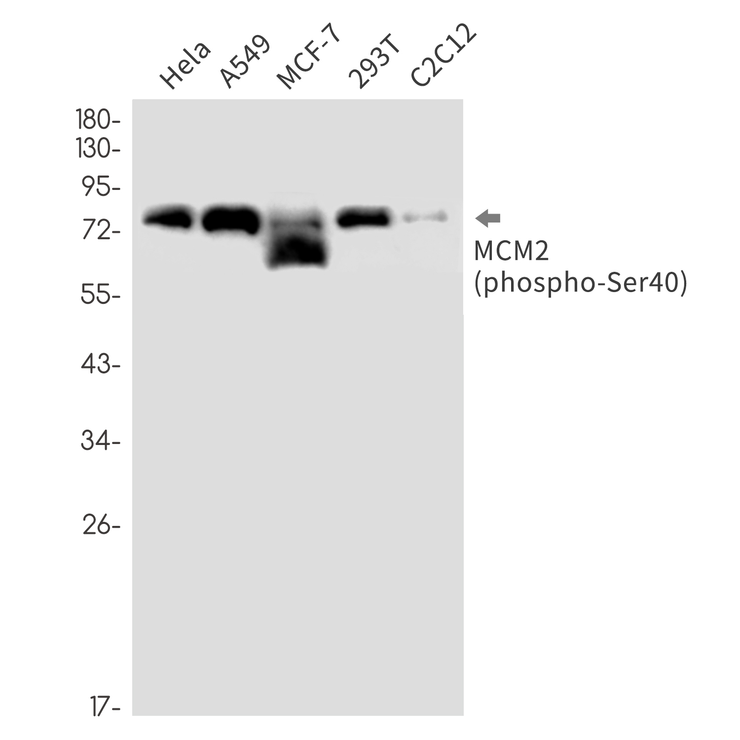 Phospho-MCM2 (Ser40) Rabbit mAb ABZ4397