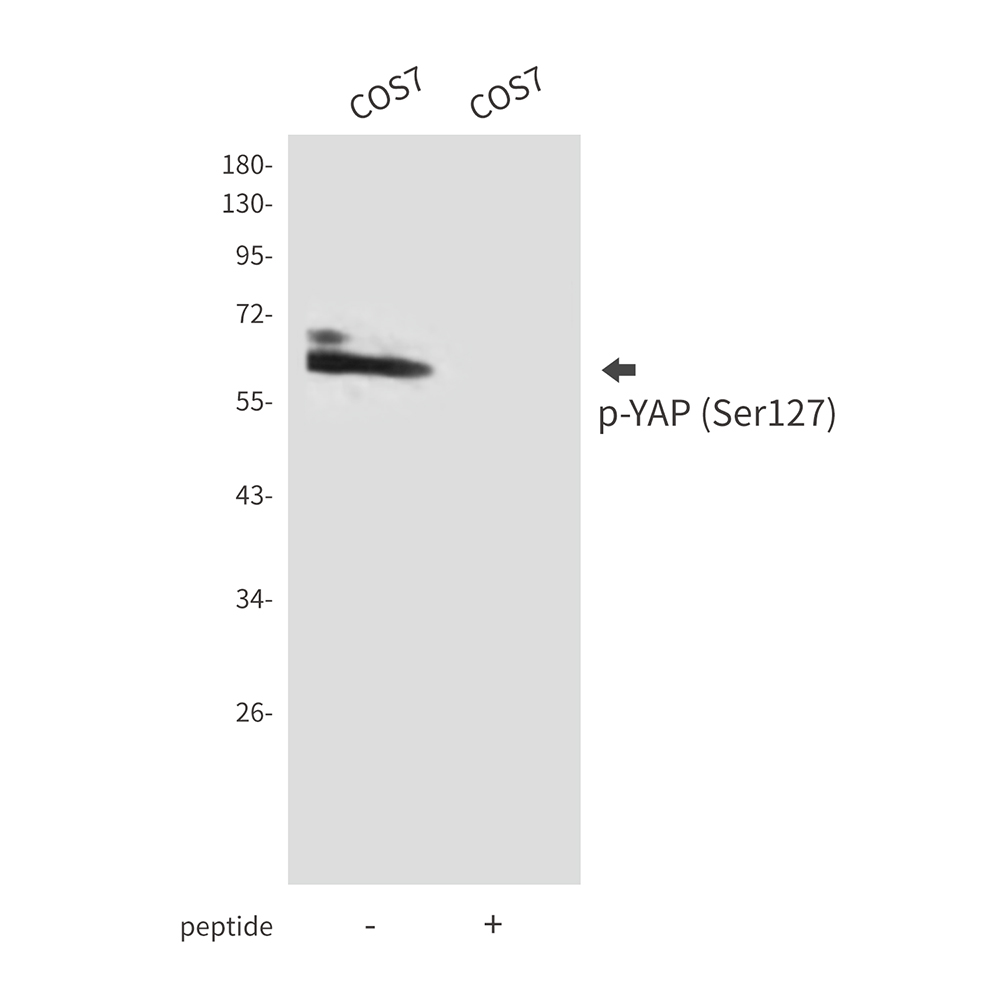 Phospho-YAP1 (Ser127) Rabbit pAb ABZ4398