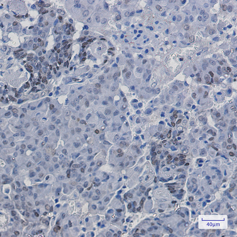 Phospho-p27 KIP 1 (Ser10) Rabbit mAb ABZ4400