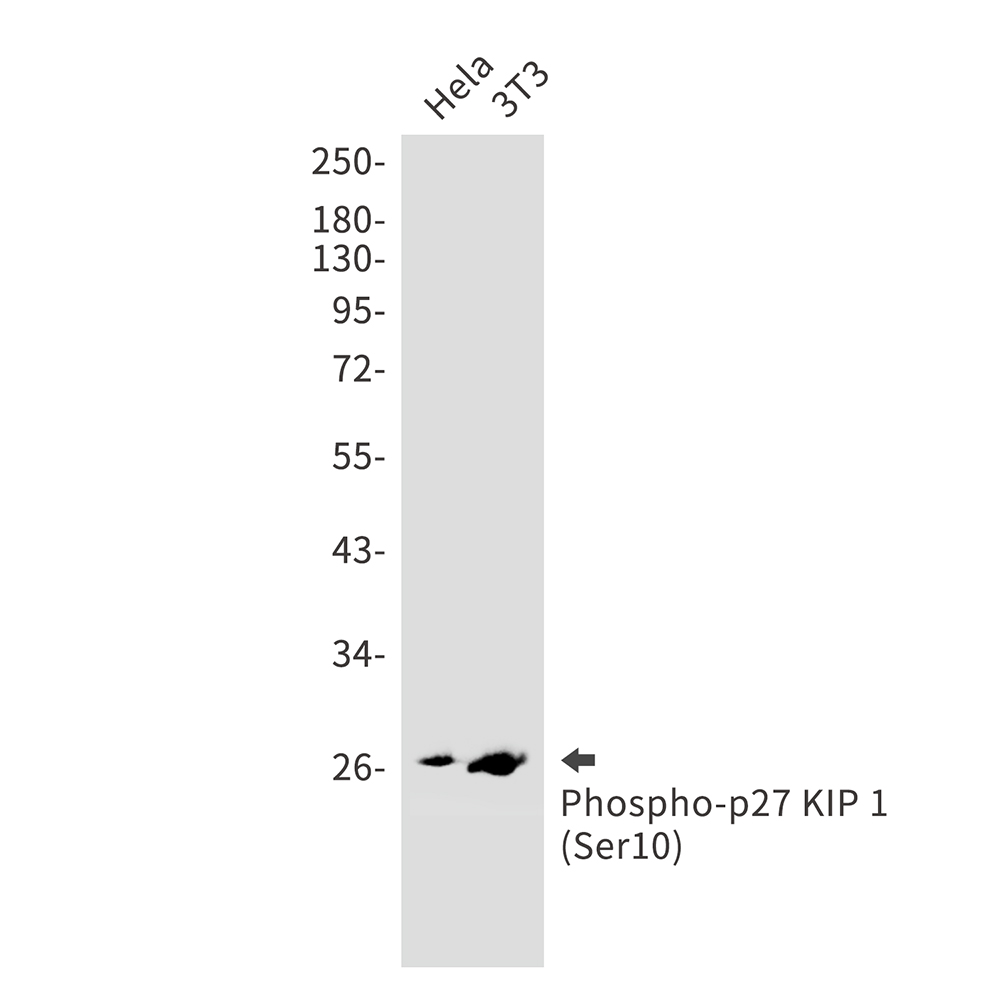 Phospho-p27 KIP 1 (Ser10) Rabbit mAb ABZ4400