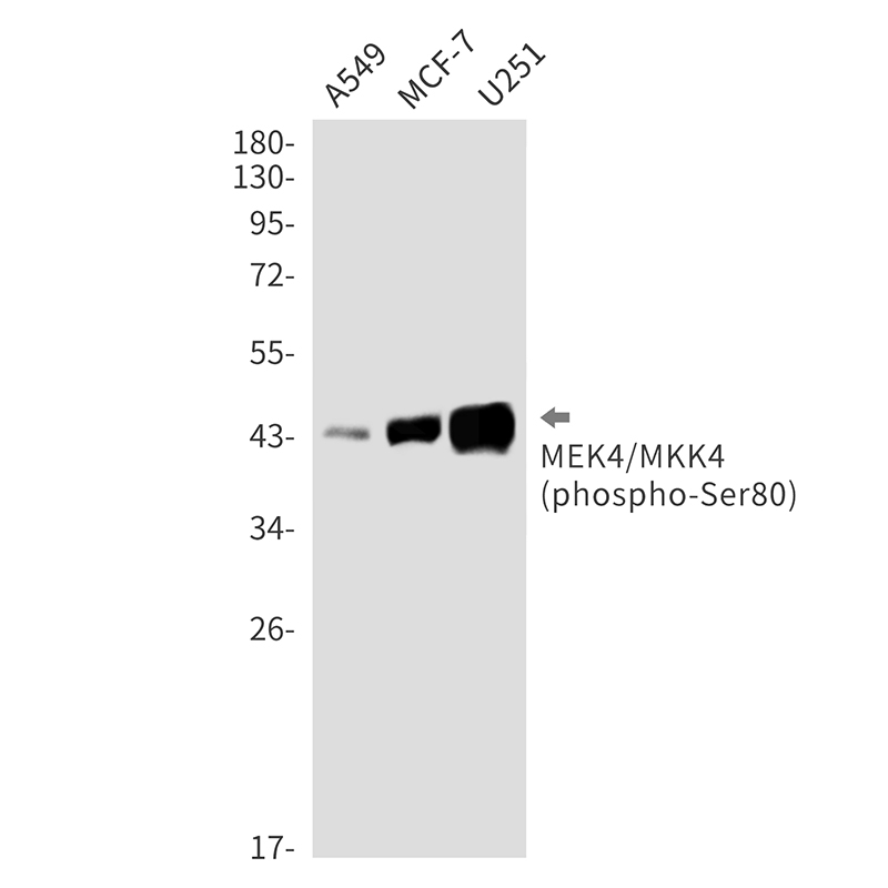 Phospho-MEK4 (Ser80) Rabbit mAb ABZ4401