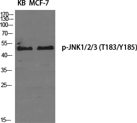 Phospho-JNK1/2/3 (Thr183/Tyr185) Rabbit pAb ABZ4404