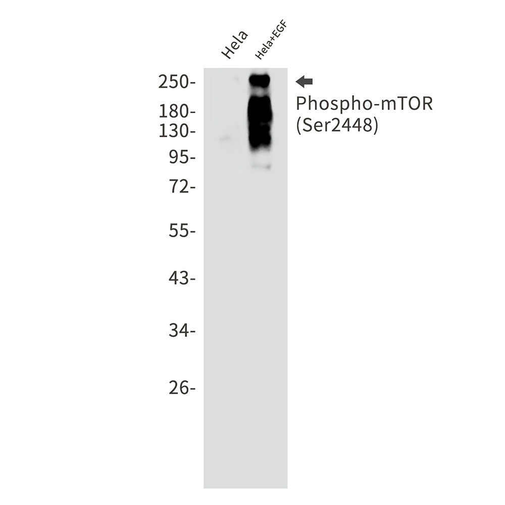 Phospho-mTOR (Ser2448) Rabbit mAb ABZ4407