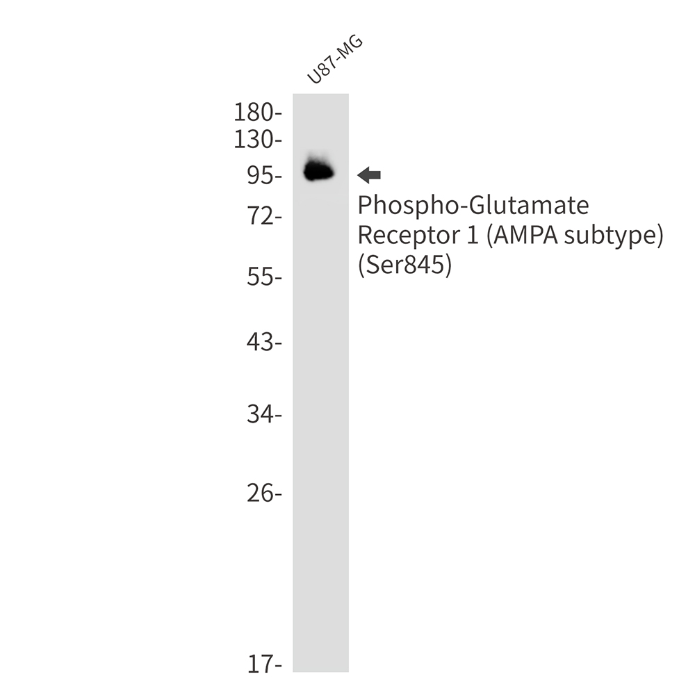 Phospho-Glutamate Receptor 1 (AMPA Subtype) (Ser845) Rabbit mAb ABZ4408