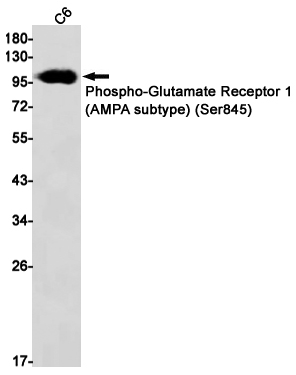 Phospho-Glutamate Receptor 1 (AMPA Subtype) (Ser845) Rabbit mAb ABZ4408