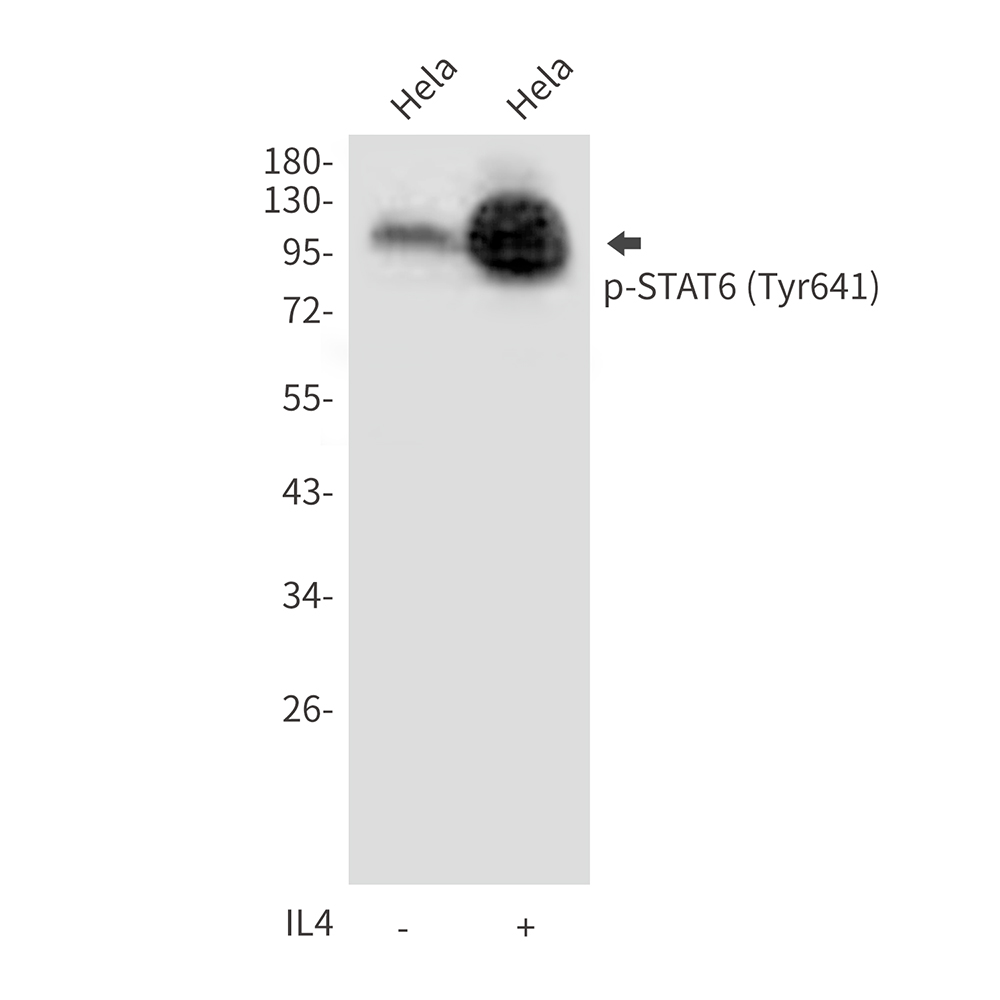 Phospho-STAT6 (Tyr641) Rabbit pAb ABZ4409