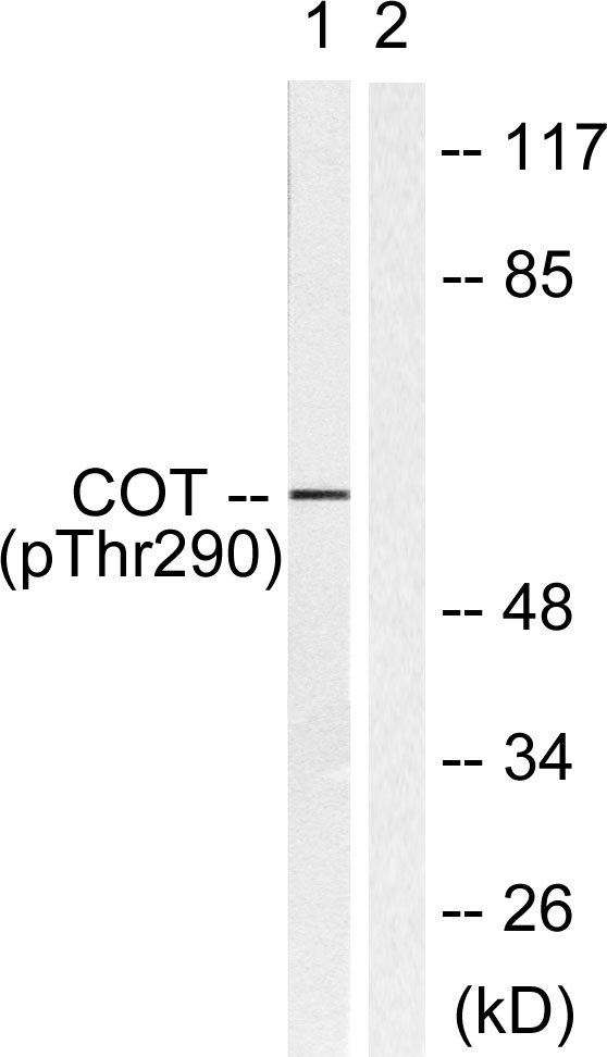 Phospho-MAP3K8/COT (Thr290) Rabbit pAb ABZ4412